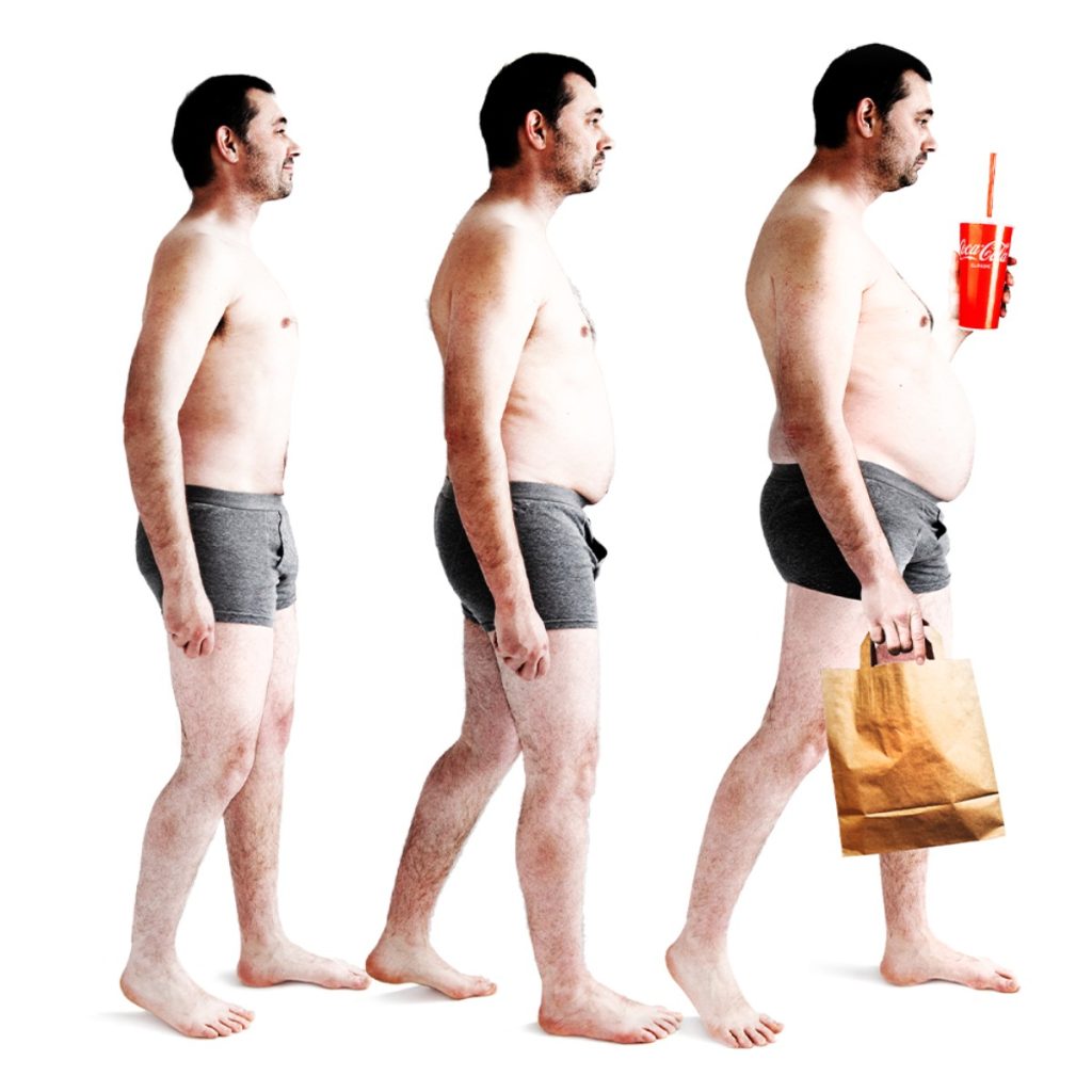 dinh dưỡng trong thừa cân béo phì