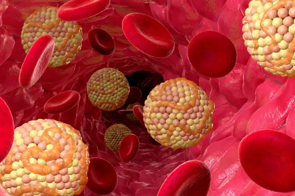 dinh dưỡng điều trị rối loạn lipid máu