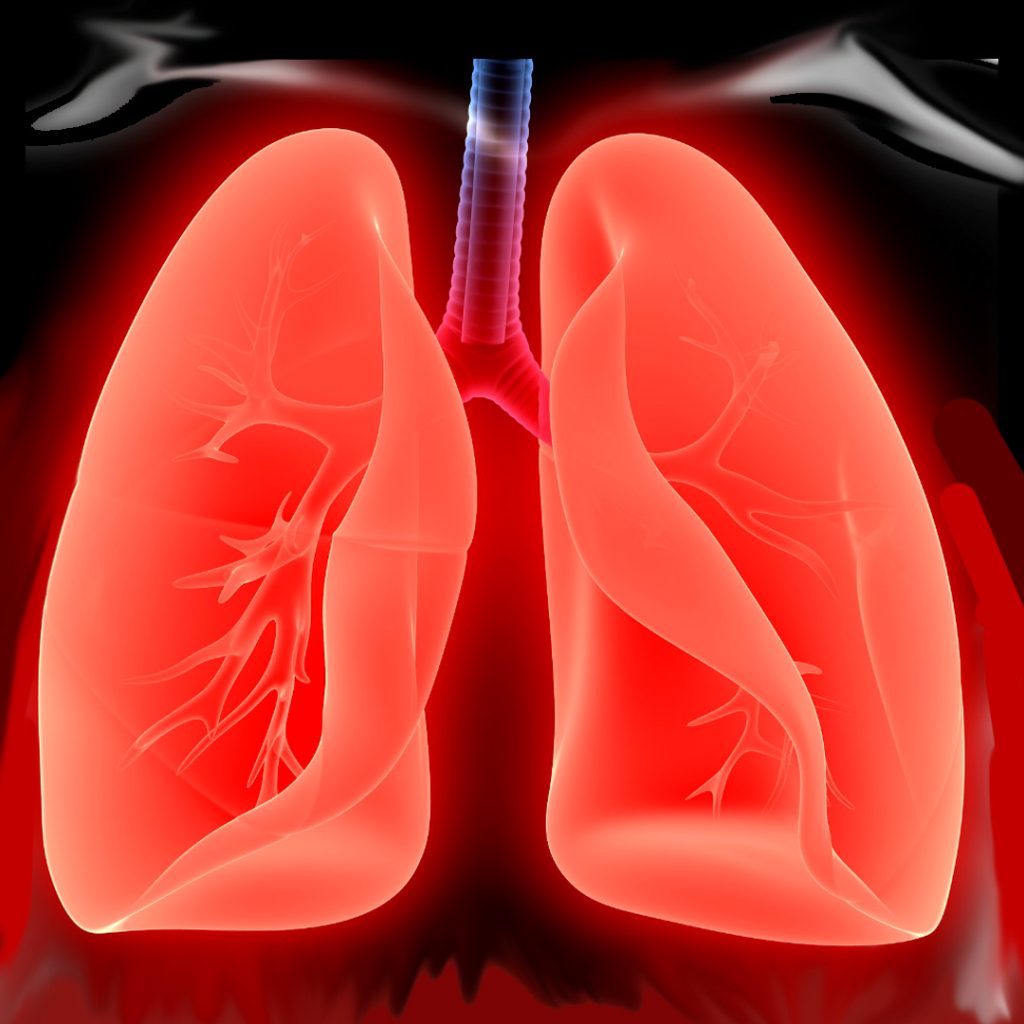 chẩn đoán viêm phổi