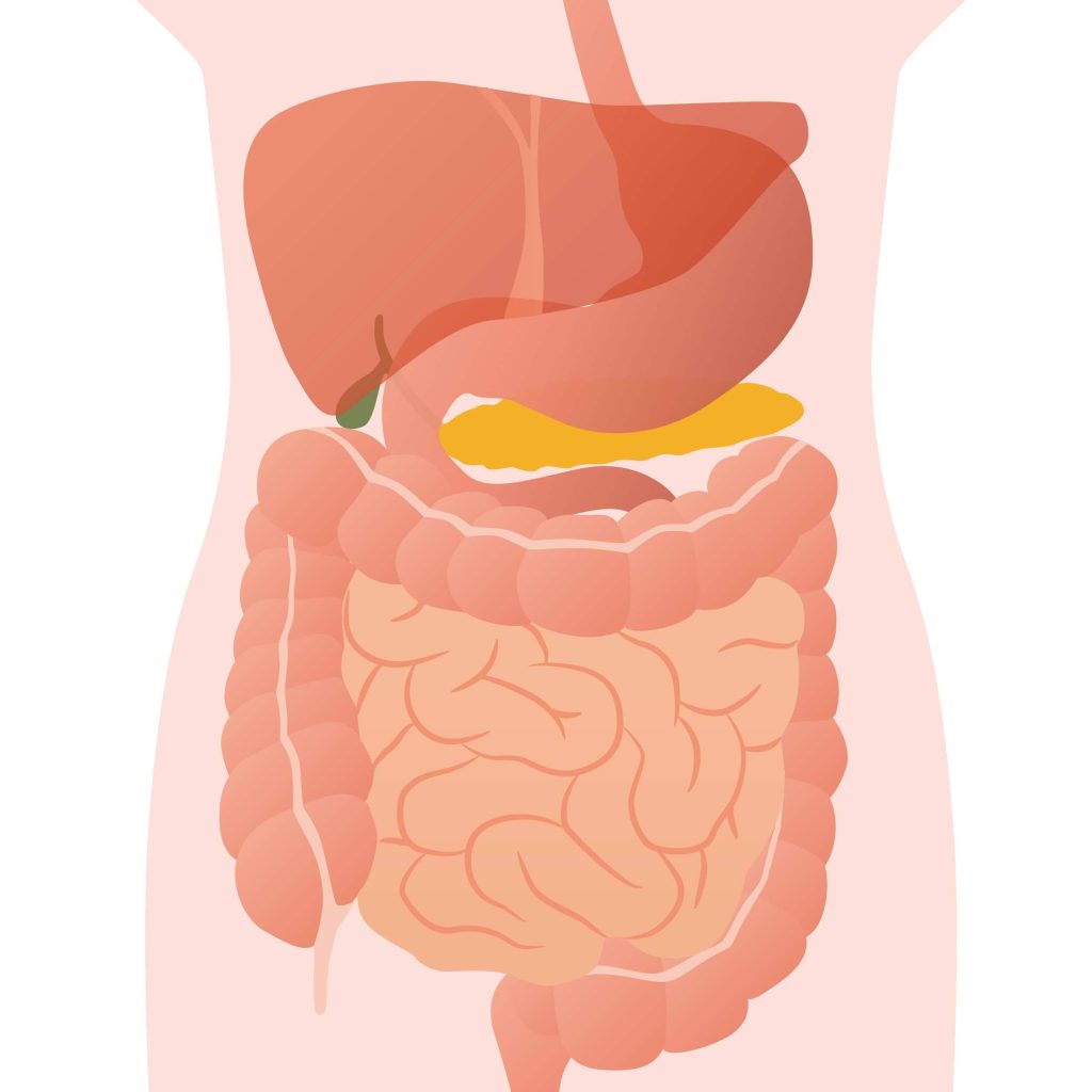 hội chứng kém hấp thu