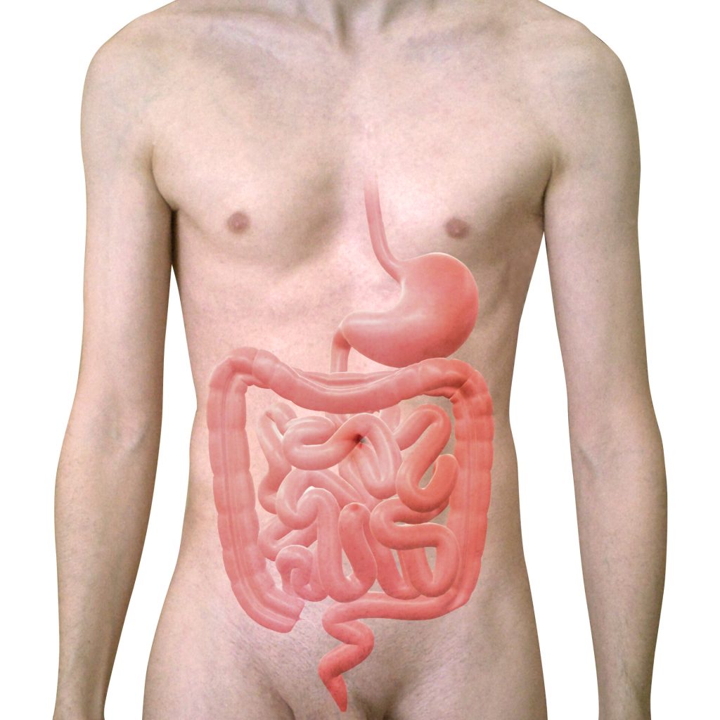 hội chứng kém hấp thu